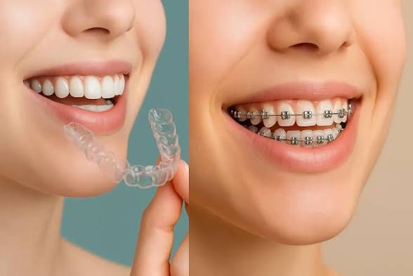 Orthodontic