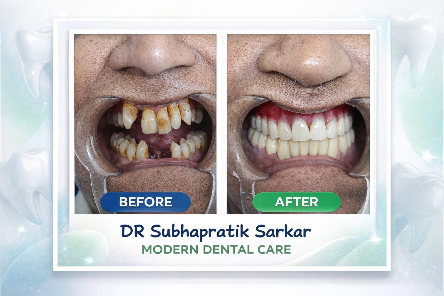 Before and After Transformation 4